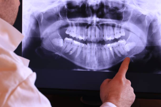 Best Tooth Pain Emergency Relief  in Pollock Pines, CA