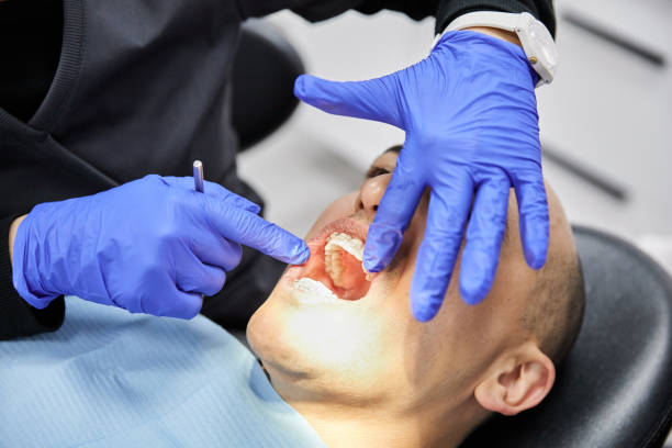Best Dentist for Severe Toothache  in Pollock Pines, CA